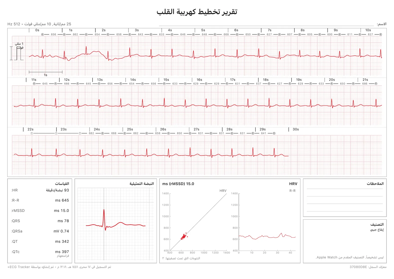 تقرير PDF من ECG Tracker+ جاهز للطباعة: شريط تخطيط قلب مُعاير مدته 30 ثانية مع علامات R-R، إضافة إلى قياسات، ونبضة تمثيلية، ومخطّط HRV، وتصنيف النظم.