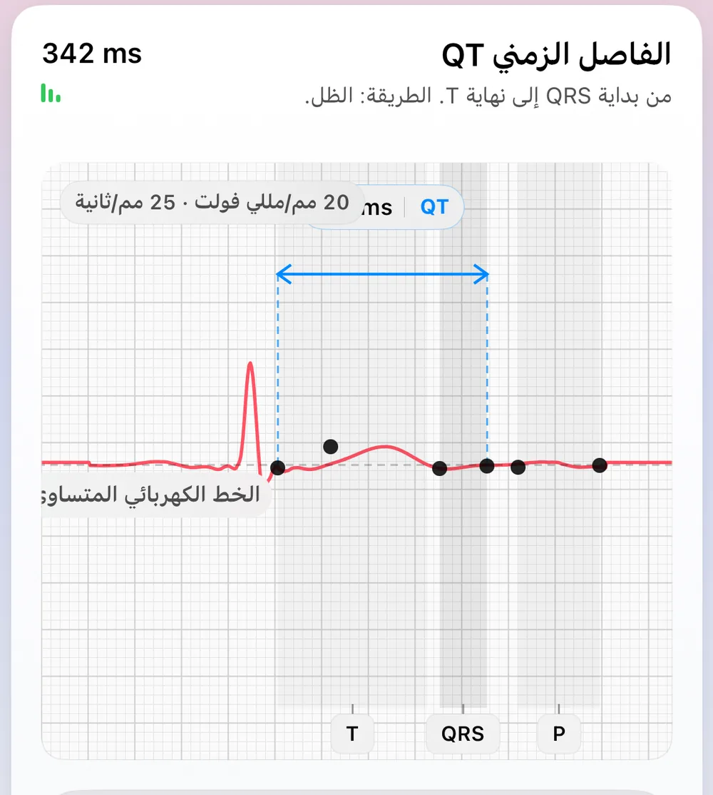 شاشة شكل النبضة في ECG Tracker+: نبضة تمثيلية مبنية من أكثر النبضات ثباتًا، مع علامات مرجعية P وQRS وT، والخط متساوي الجهد، وفاصل QT يبلغ 341 ms مقيسًا بطريقة المماس (من بداية QRS إلى نهاية T).