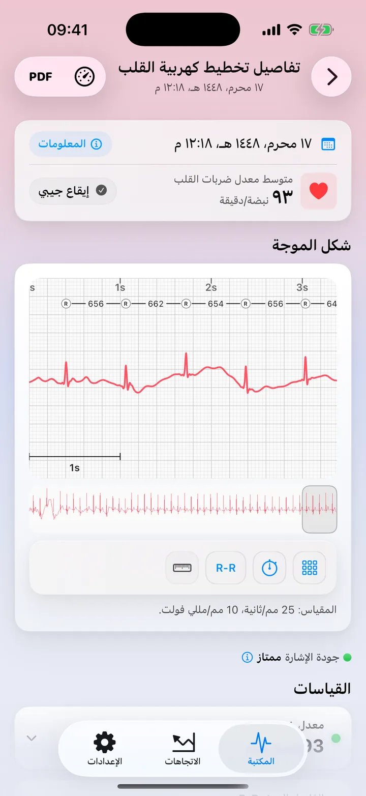 شاشة القياسات في ECG Tracker+ مع جودة إشارة ممتازة، ومعدّل ضربات القلب، وفاصل R-R، وHRV، ومدة QRS وسعته، لكل منها نقطة حالة.
