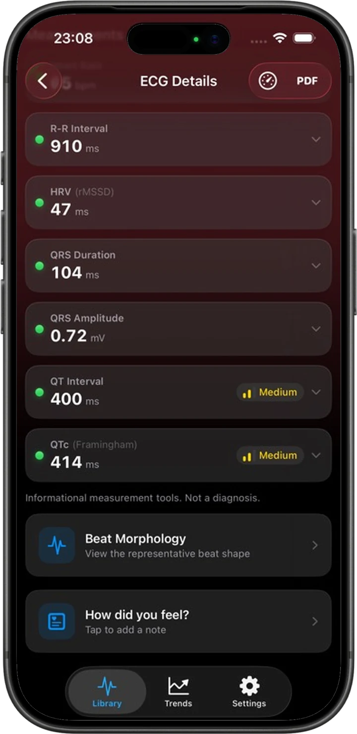 An iPhone frame showing unlocked ECG Tracker+ measurements including rMSSD, QRS, QT, and QTc