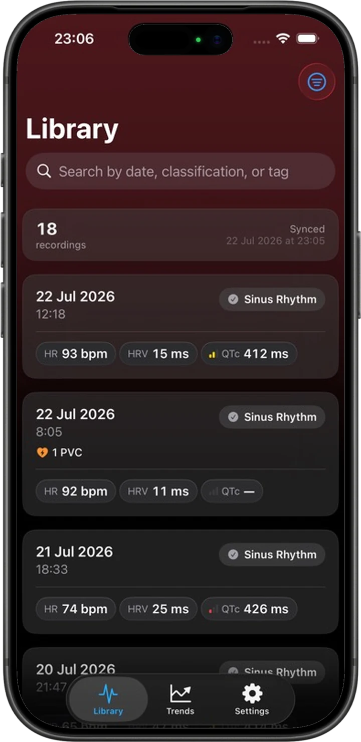 An iPhone frame showing the ECG Tracker+ library with imported Apple Watch ECG recordings