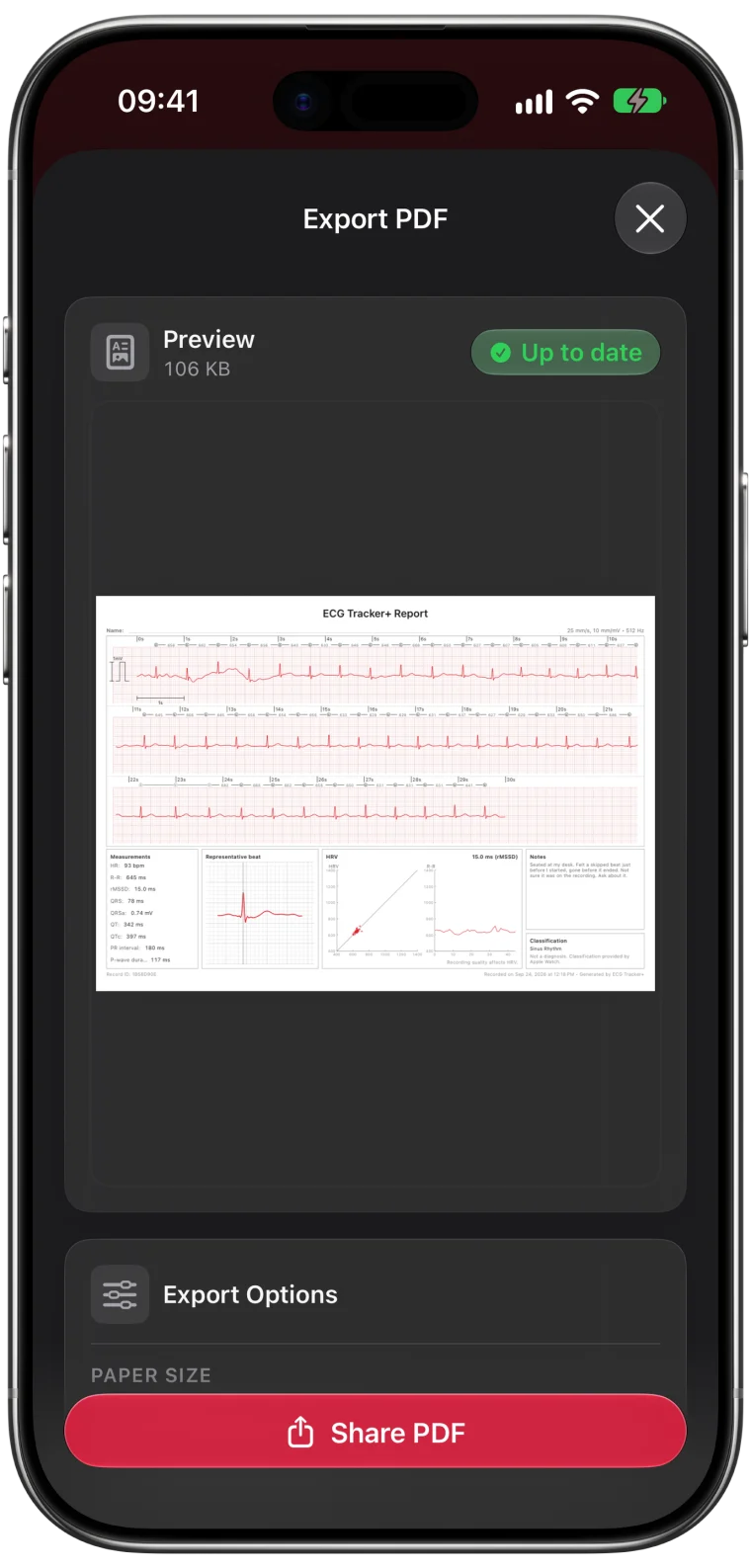 ECG Tracker+ Export PDF screen with an up-to-date report preview, export options and a Share PDF button
