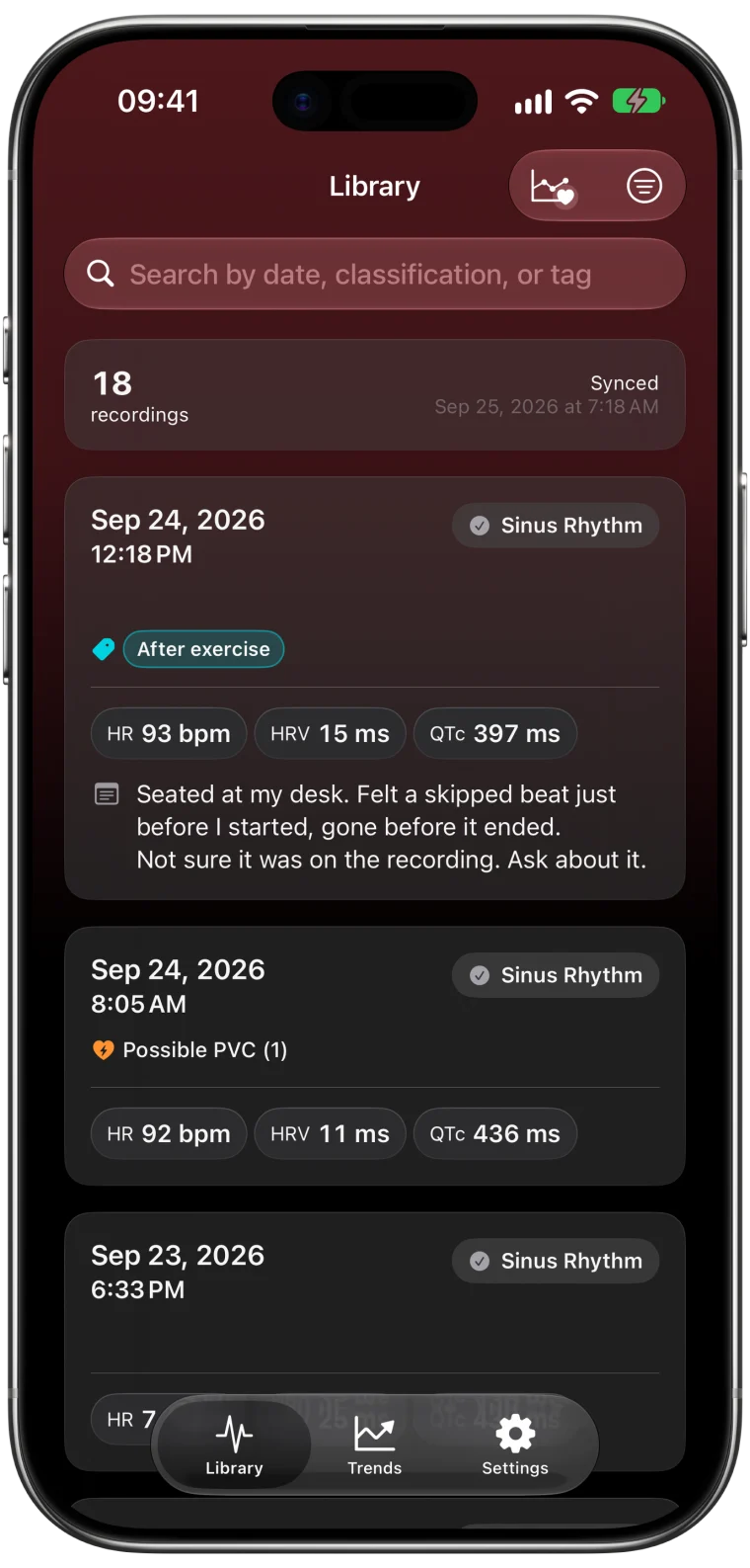 ECG Tracker+ Library listing 18 Apple Watch ECG recordings, each with its classification, heart rate, HRV and QTc, plus a tag, a note and a possible PVC