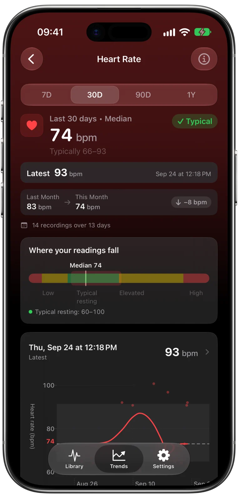 ECG Tracker+ Heart Rate trend for the last 30 days: a median of 74 bpm, 8 bpm lower than the month before, a typical range of 66 to 93 bpm and a latest reading of 93 bpm