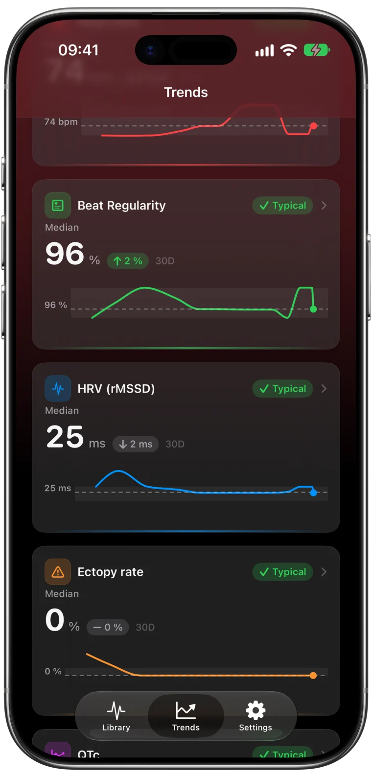ECG Tracker+ Trends cards for the last 30 days: beat regularity 96%, HRV (rMSSD) 25 ms and ectopy rate 0%, each marked typical with its chart