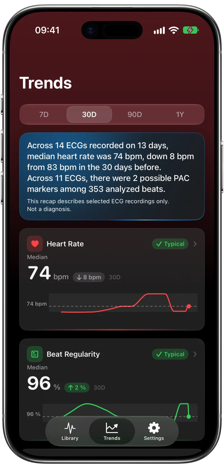 ECG Tracker+ Trends for the last 30 days: a plain-language recap across 14 ECGs with a 74 bpm median heart rate, and heart rate and beat regularity charts