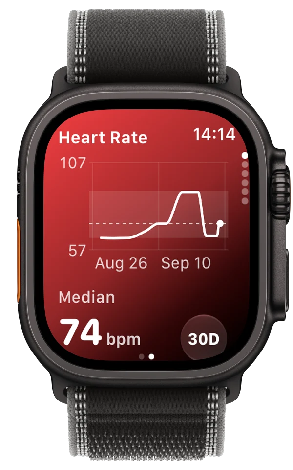 ECG Tracker+ on Apple Watch Ultra showing a 30-day heart rate trend with a median of 74 bpm