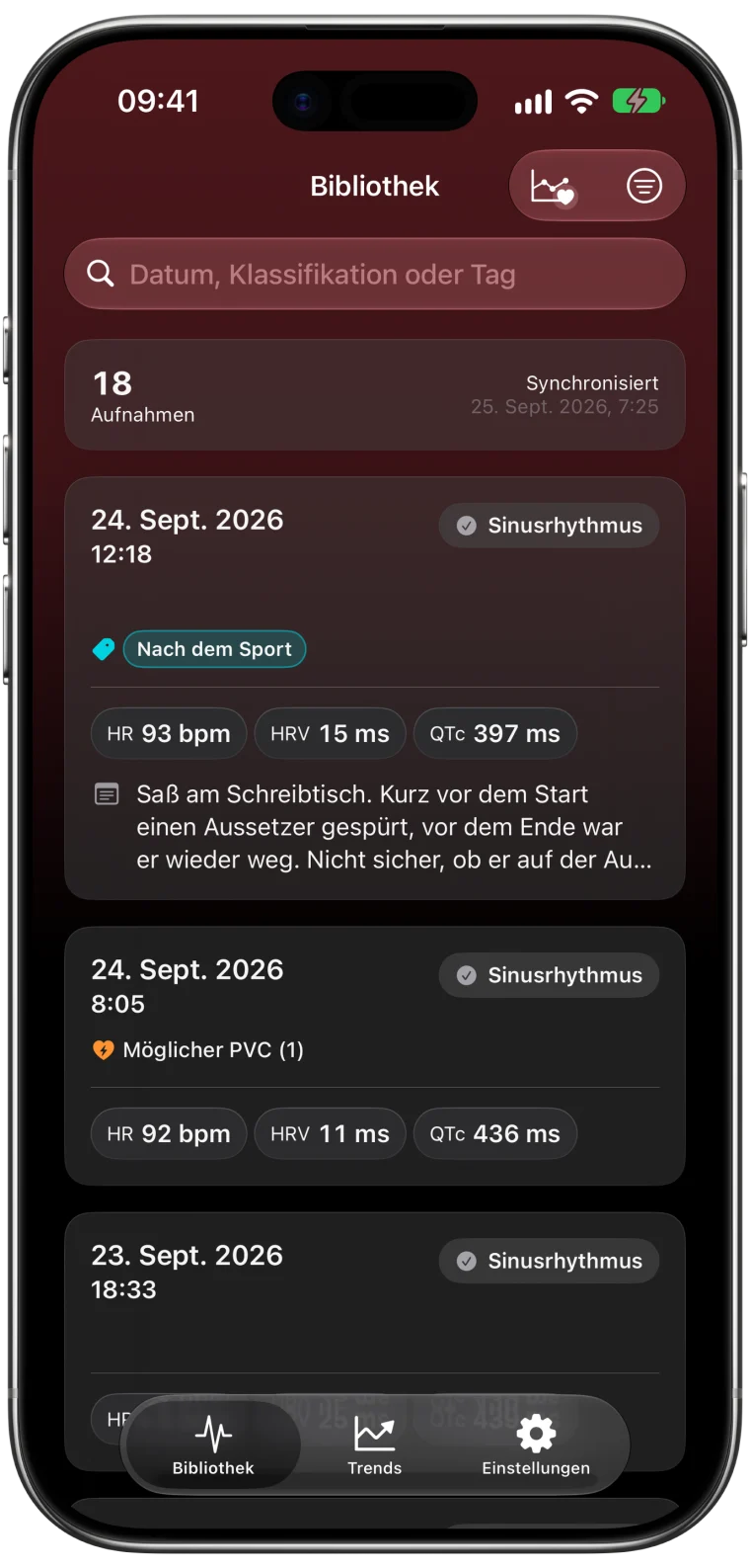 Bibliothek von ECG Tracker+ mit 18 EKG-Aufzeichnungen der Apple Watch, jeweils mit Klassifizierung, Herzfrequenz, HRV und QTc, dazu ein Tag, eine Notiz und ein möglicher PVC