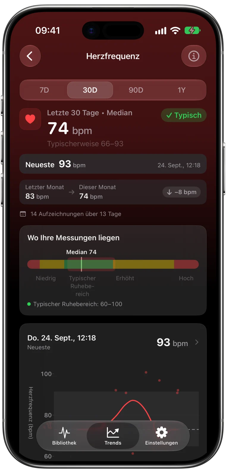 Trend der Herzfrequenz in ECG Tracker+ für die letzten 30 Tage mit einem Median von 74 bpm, der 8 bpm niedriger ist als im Vormonat, einem typischen Bereich von 66 bis 93 bpm und dem neuesten Messwert von 93 bpm
