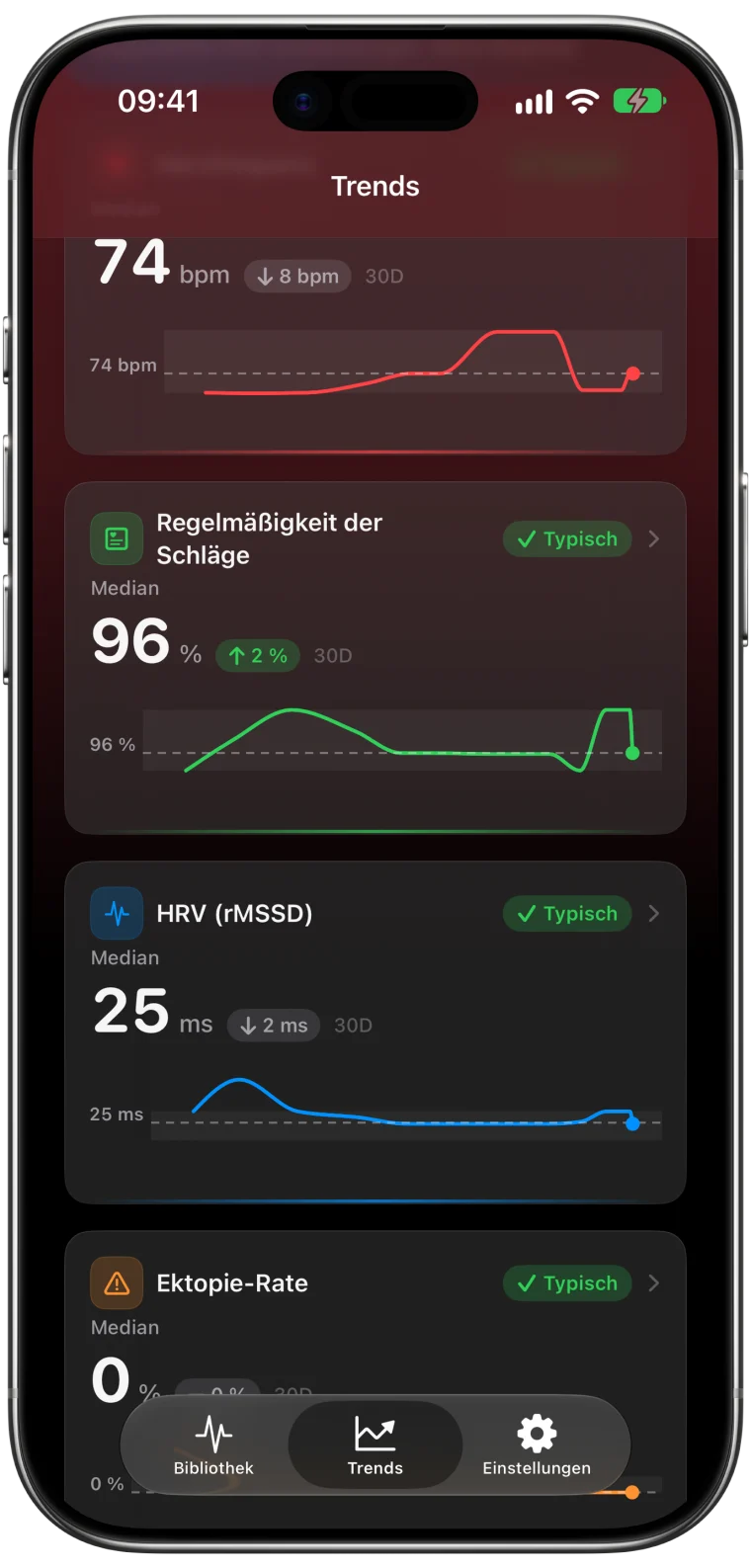 Trends-Karten in ECG Tracker+ für die letzten 30 Tage mit Regelmäßigkeit der Schläge 96 %, HRV (rMSSD) 25 ms und Ektopie-Rate 0 %, jeweils als „Typisch“ eingestuft und mit Diagramm