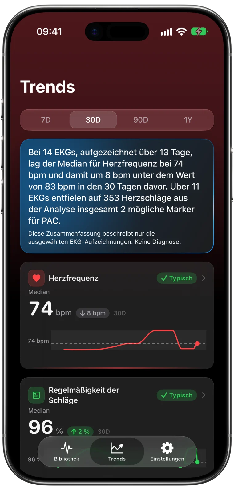 Trends in ECG Tracker+ für die letzten 30 Tage mit einer verständlichen Zusammenfassung über 14 EKGs, einer medianen Herzfrequenz von 74 bpm und Diagrammen zu Herzfrequenz und Regelmäßigkeit der Schläge
