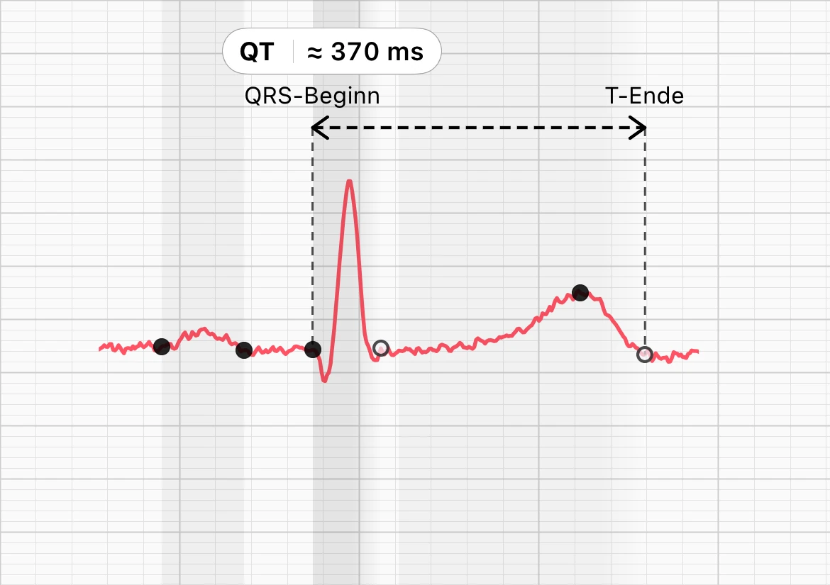 Ein Herzschlag aus derselben Aufzeichnung in der Schlagmorphologie von ECG Tracker+, mit gestrichelten Linien am Beginn des QRS und am Ende der T-Welle und der Beschriftung QT etwa 370 ms