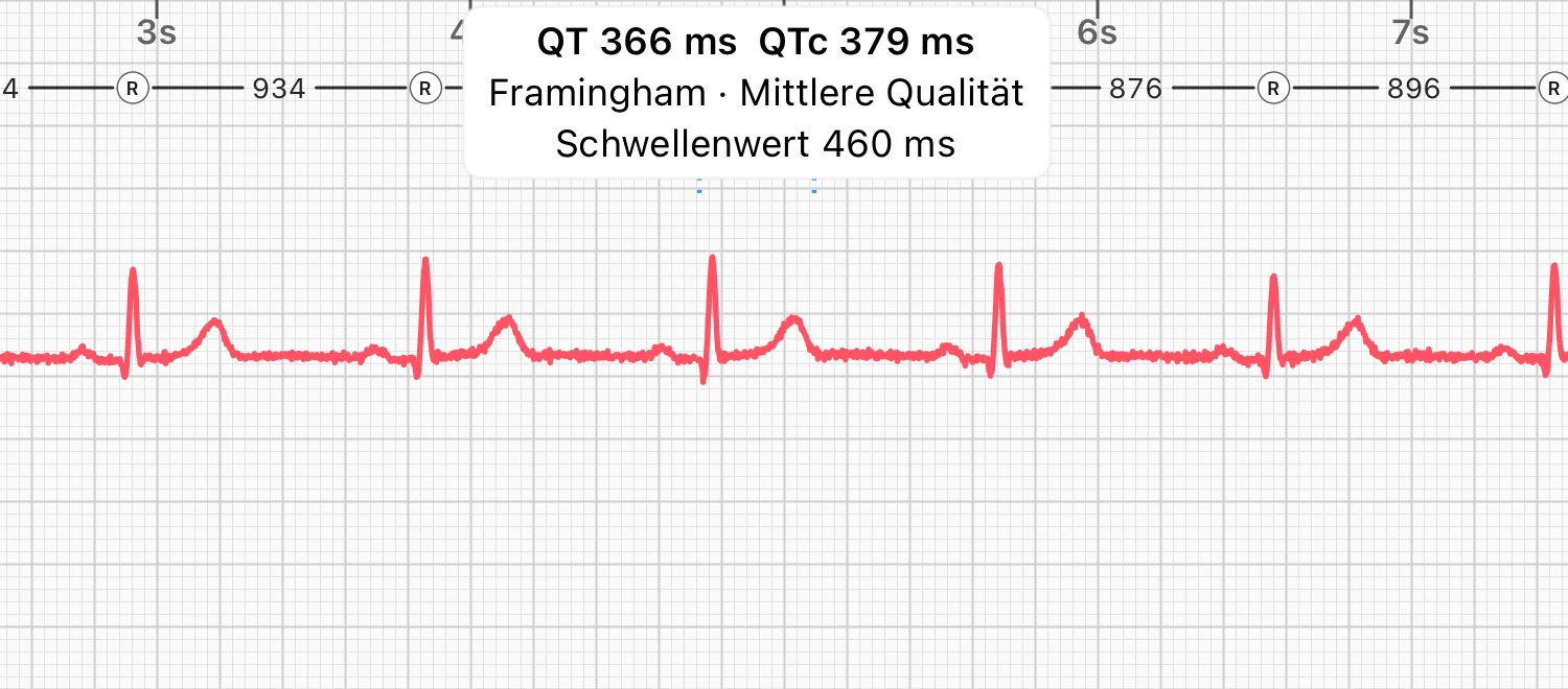 Zehn Sekunden eines Ruhe-EKGs in Ableitung I, das QT-Intervall eines Schlags von ECG Tracker+ mit einer Klammer markiert und mit QT 366 ms und QTc 379 ms beschriftet