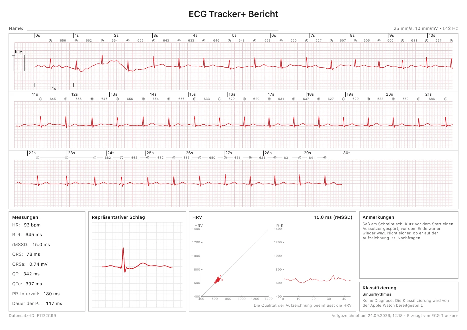 Ein druckfertiger PDF-Bericht von ECG Tracker+: ein kalibrierter 30-Sekunden-EKG-Streifen mit R-R-Markern, dazu Messwerte, ein repräsentativer Schlag, ein HRV-Diagramm und die Rhythmusklassifizierung