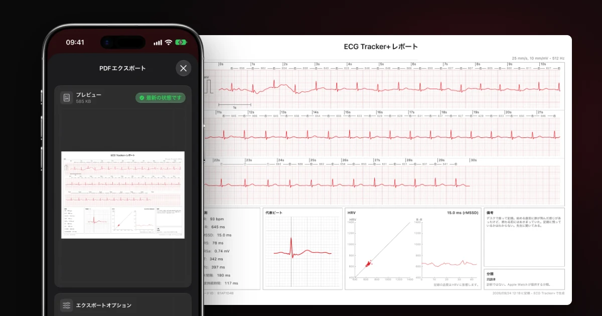 ECG Tracker+のPDFエクスポートのプレビューを表示したiPhoneと、その横に並べたデモ用の詳しい心電図レポート