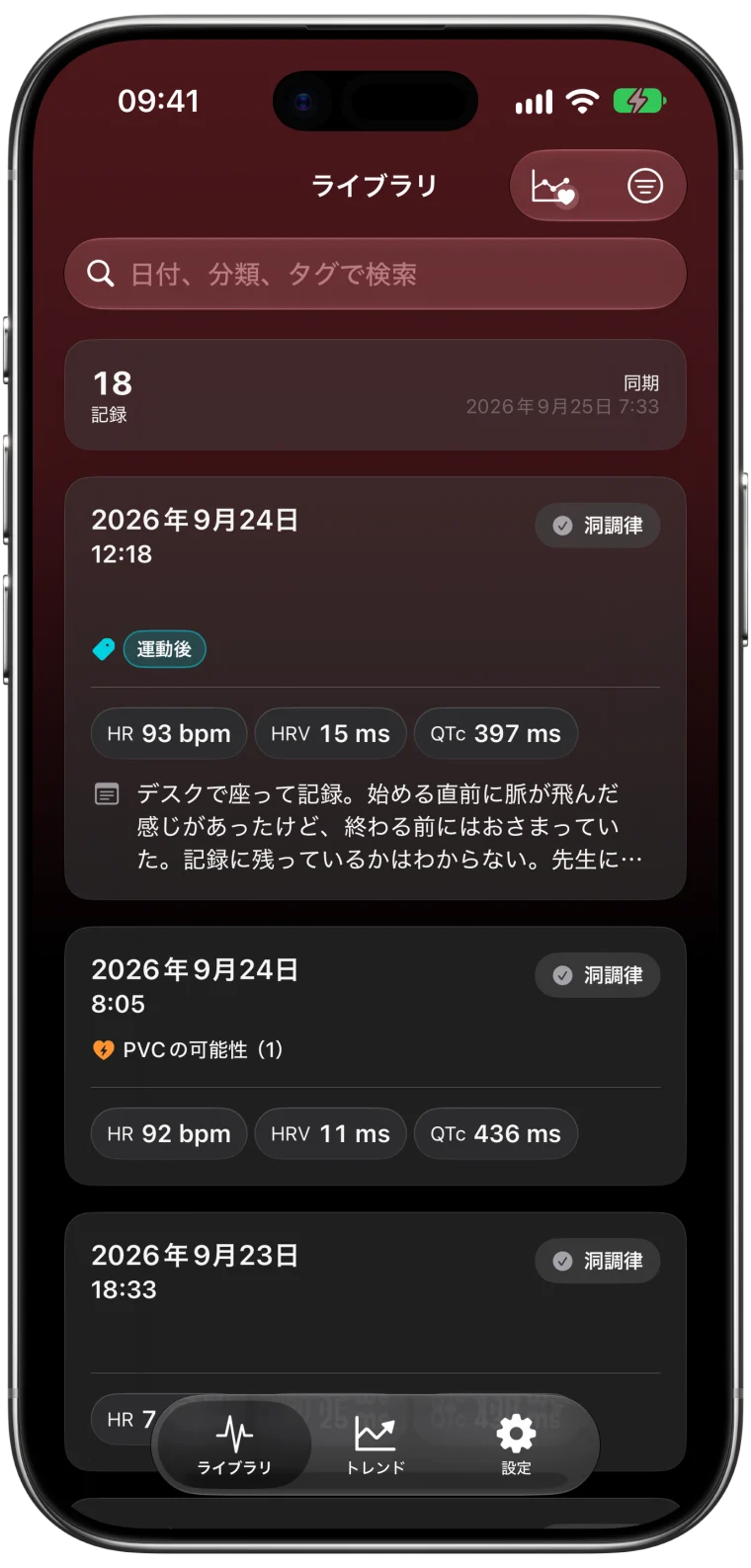 Apple Watchの心電図記録18件を一覧表示したECG Tracker+のライブラリ。各記録に分類、心拍数、HRV、QTcが並び、タグ、メモ、PVCの可能性の表示も確認できます