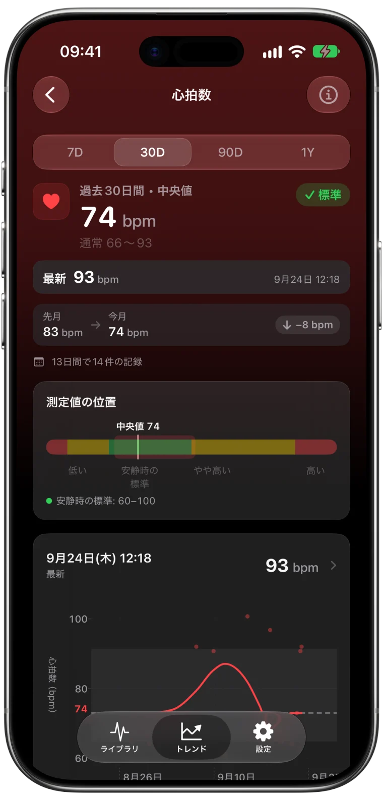 過去30日間の心拍数のトレンドを表示したECG Tracker+の画面。中央値74 bpm、通常66〜93 bpm、最新の測定値93 bpm、今月は先月より8 bpm低下