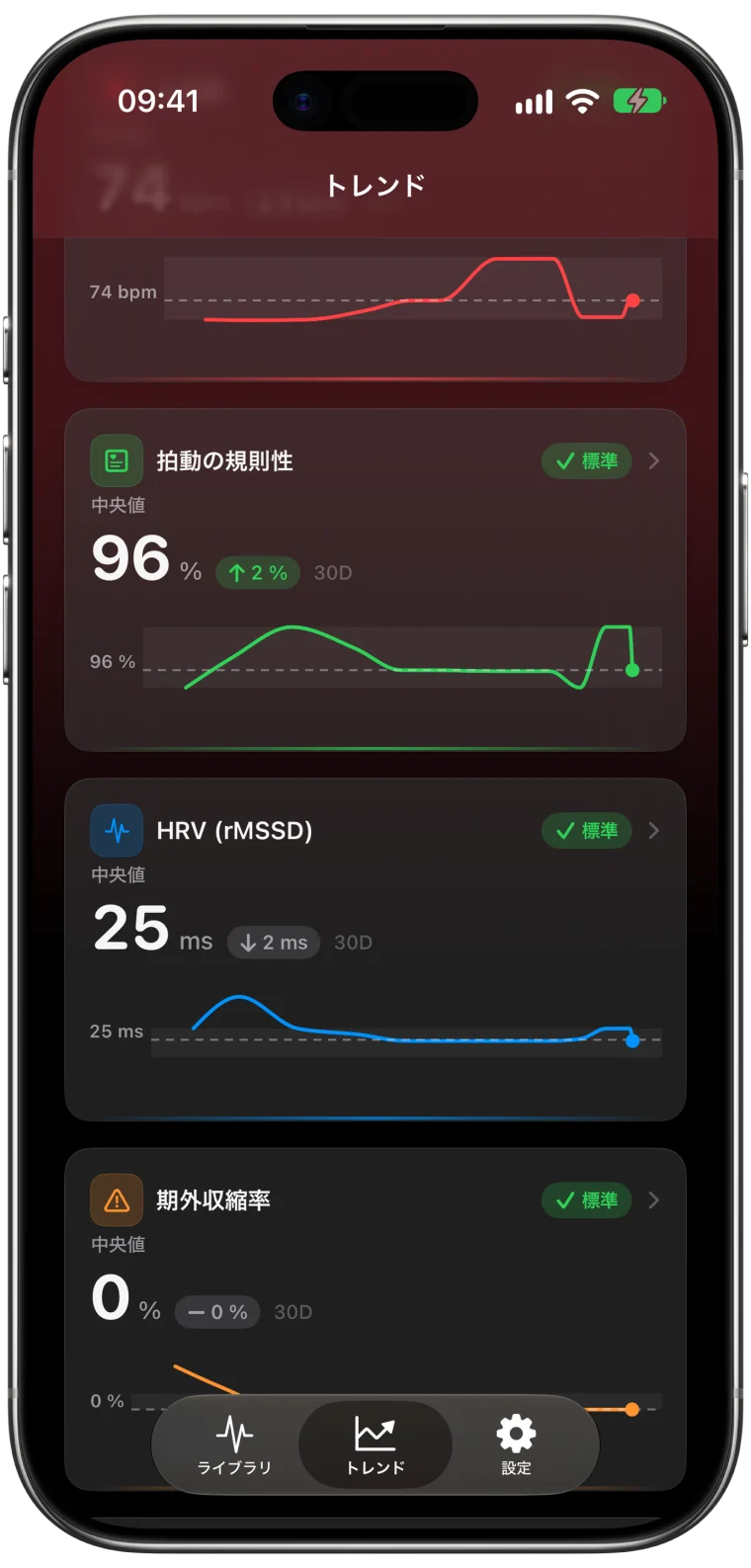 過去30日間のECG Tracker+「トレンド」カード。拍動の規則性96%、HRV（rMSSD）25 ms、期外収縮率0%を、それぞれ「標準」のラベルとグラフ付きで表示