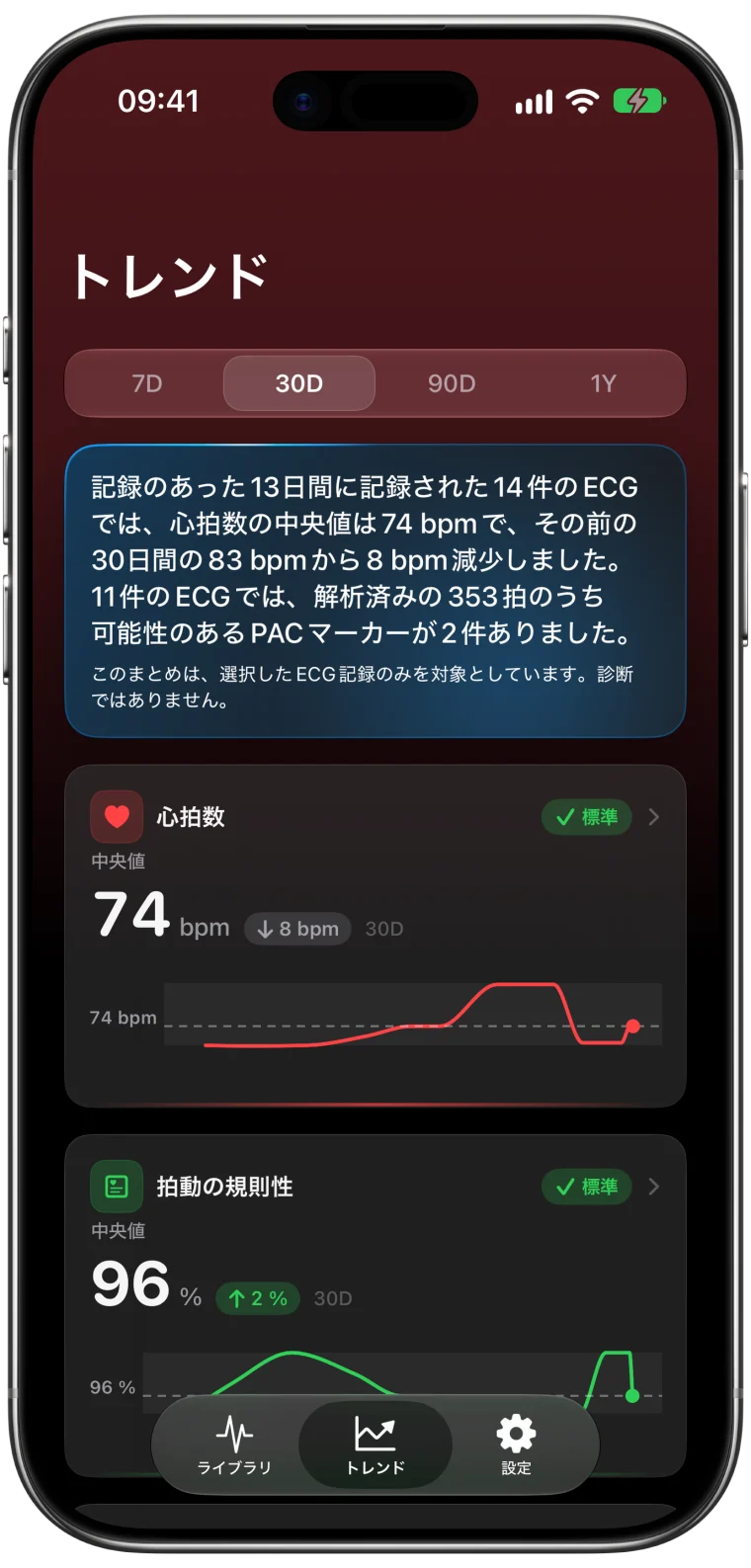 過去30日間を表示したECG Tracker+の「トレンド」画面。14件の心電図をもとにした分かりやすい振り返り（心拍数の中央値74 bpm）と、心拍数および拍動の規則性のグラフ