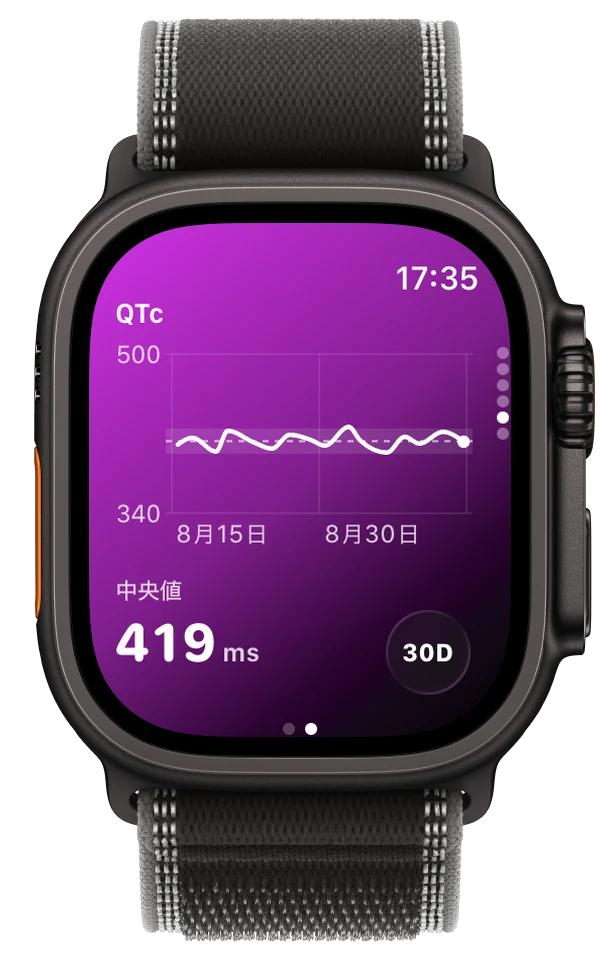 Apple Watch UltraのECG Tracker+。30日間のQTcのトレンドを表示（中央値419 ms）