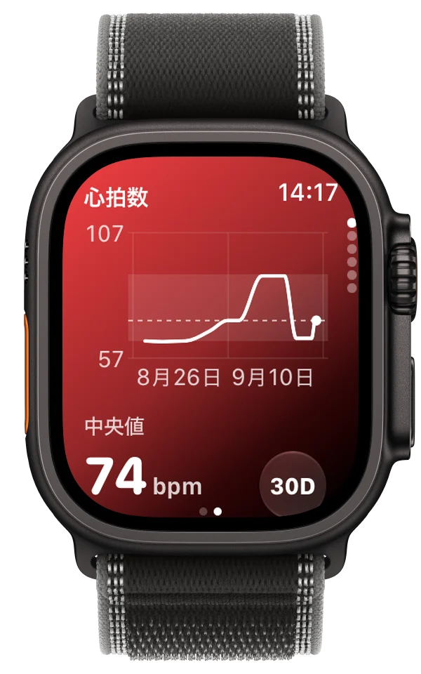 過去30日間の心拍数のトレンド（中央値74 bpm）を表示した、Apple Watch Ultra上のECG Tracker+