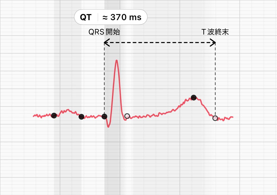 同じ記録をECG Tracker+の「拍動形態」で表示した1拍。「QRS開始」と「T波終末」の位置に破線が引かれ、QTが約370 msであることを示すラベルが付いている