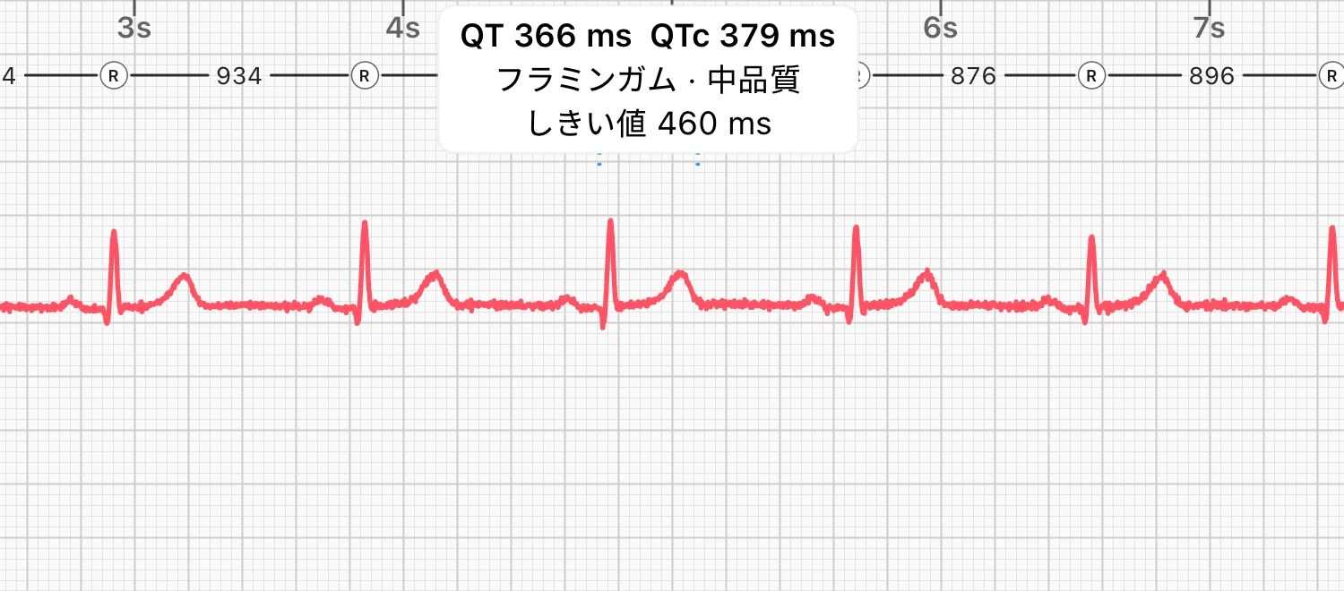 安静時に第I誘導でとった10秒間の心電図。1拍のQT間隔に括弧が付き、ECG Tracker+によって「QT 366 ms」「QTc 379 ms」と表示されている