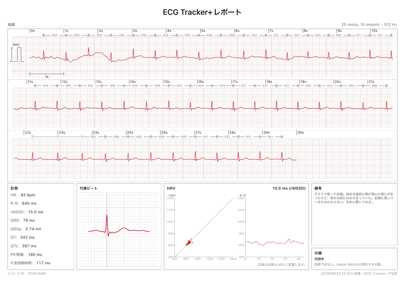 印刷に対応したECG Tracker+のPDFレポート。R-Rマーカー付きの校正済み30秒間の心電図波形に加え、測定値、代表的な拍動、HRVのグラフ、リズム分類を掲載