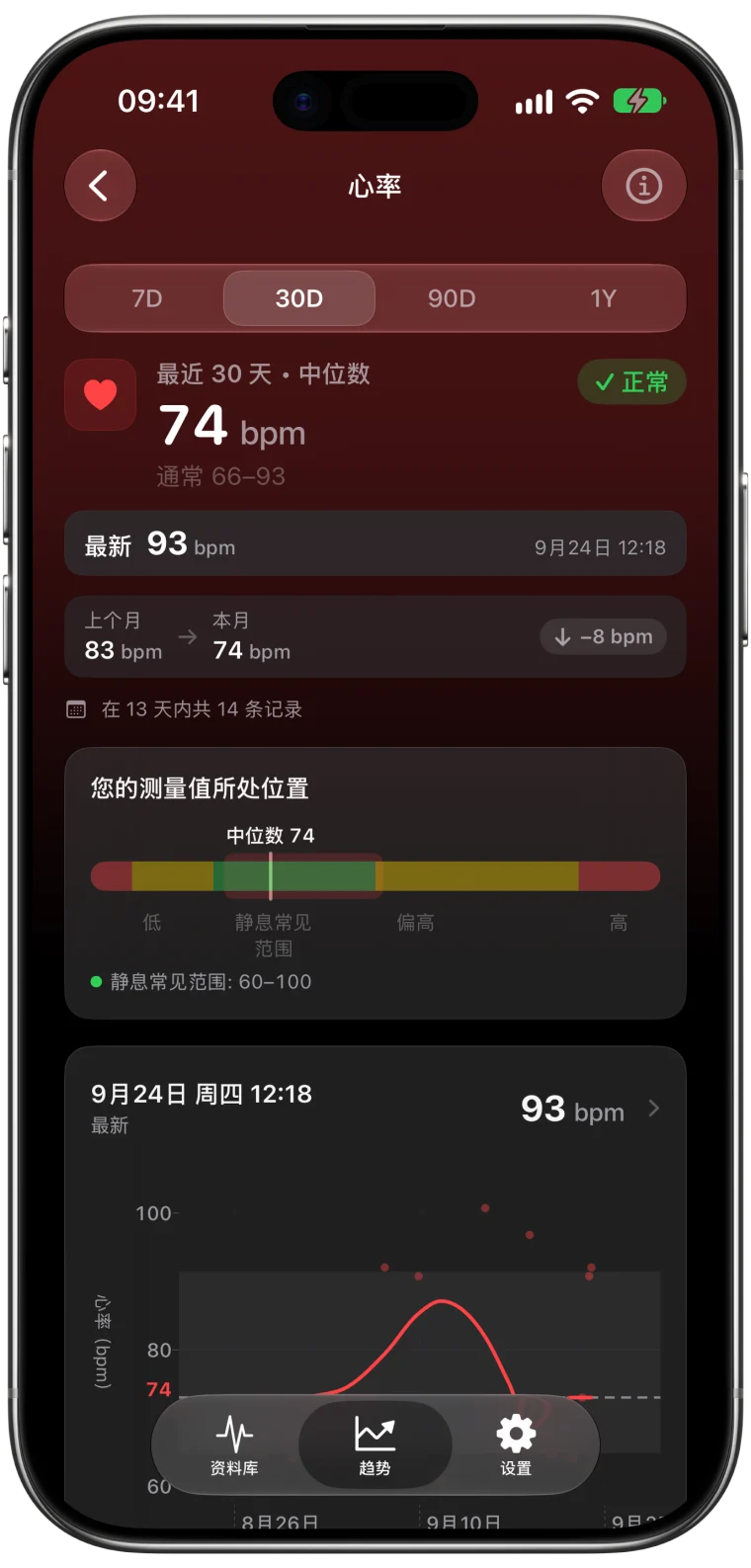 ECG Tracker+ 近 30 天的心率趋势：中位数 74 bpm，比前一个月低 8 bpm，常见范围 66 至 93 bpm，最新读数 93 bpm