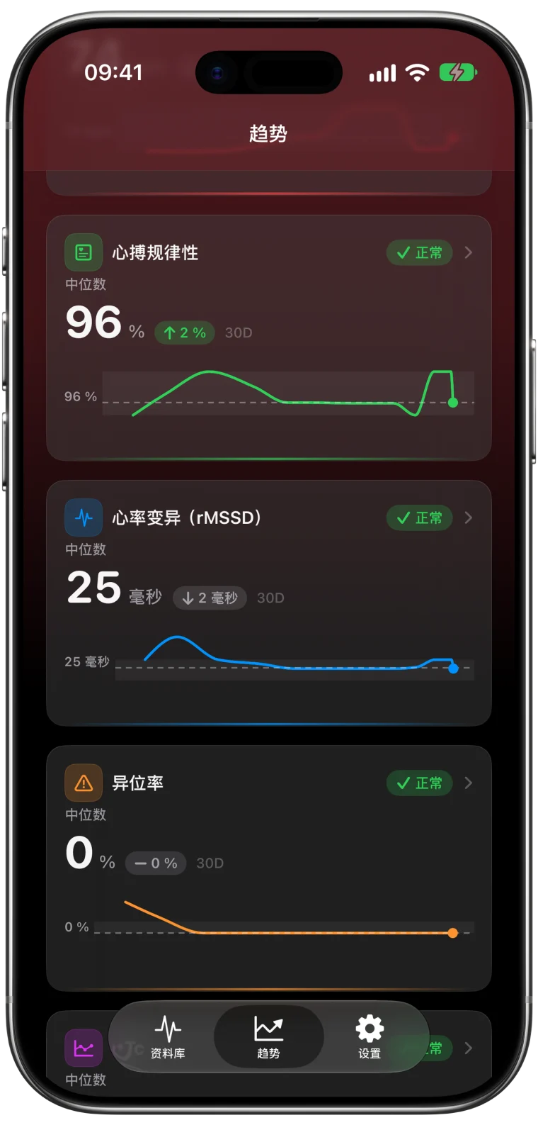 ECG Tracker+ 近 30 天的趋势卡片：心搏规律性 96%，HRV（rMSSD）25 ms，异位率 0%，每项都标示为处于平常范围，并附图表