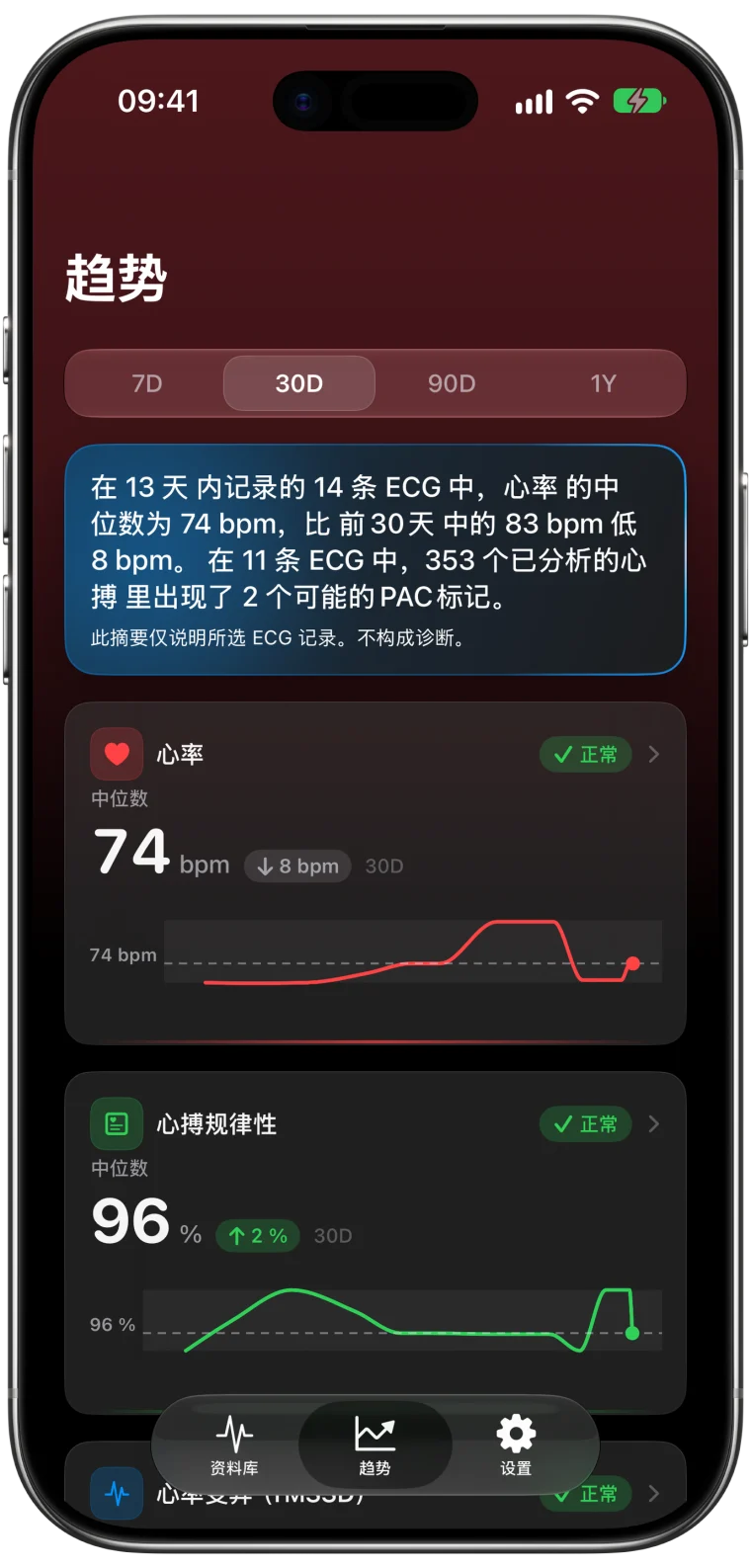 ECG Tracker+ 近 30 天的趋势：用通俗的话总结 14 份心电图，心率中位数为 74 bpm，并附心率和心搏规律性图表