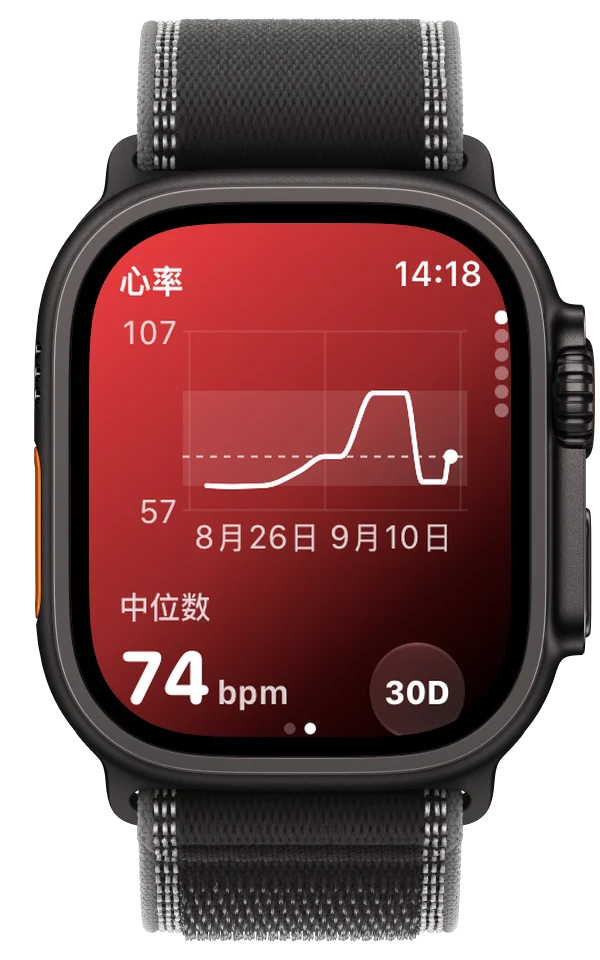Apple Watch Ultra 上的 ECG Tracker+ 显示近 30 天的心率趋势，中位数为 74 bpm