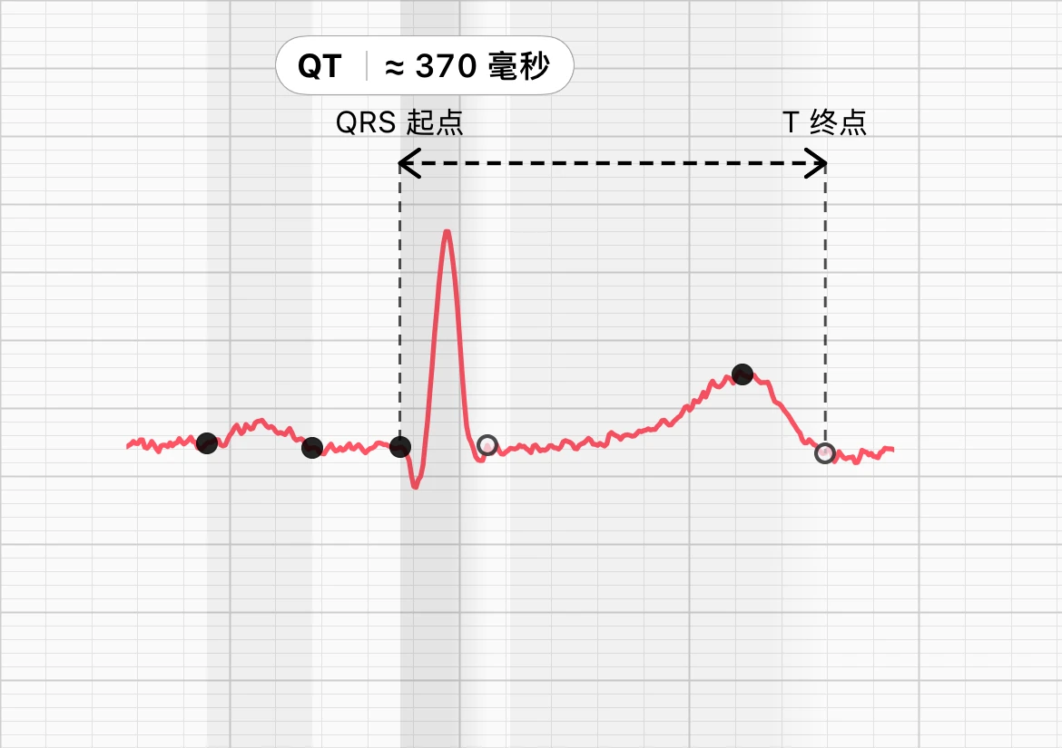 同一份记录在 ECG Tracker+ 心搏形态视图中的一次心跳，虚线分别位于 QRS 起点和 T 波终点，标注显示 QT 约 370 ms