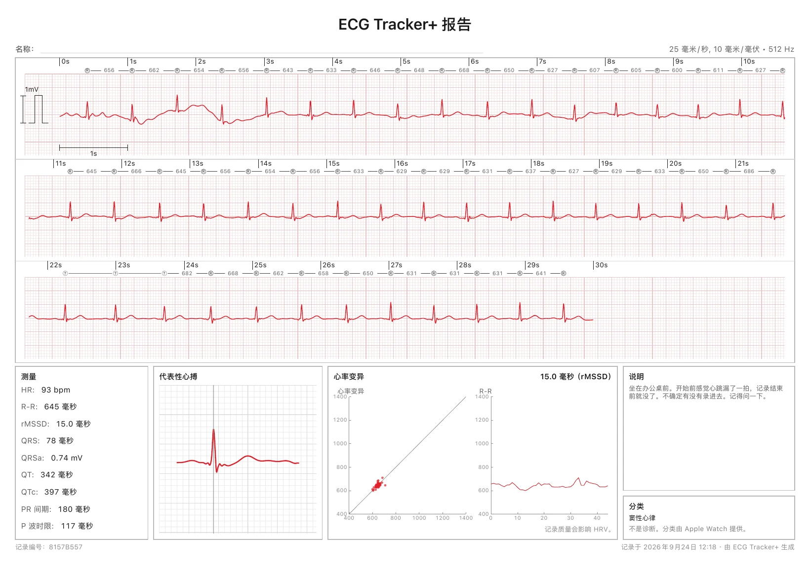 一份可直接打印的 ECG Tracker+ PDF 报告：带 R-R 标记的 30 秒校准心电图条带，以及测量值、一次代表性心搏、HRV 图表和节律分类
