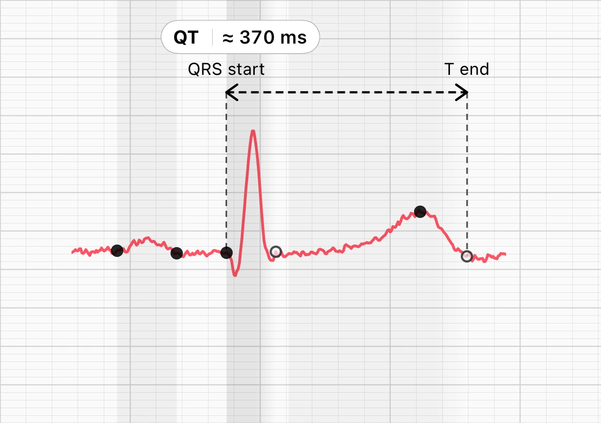 One heartbeat from the same recording in the ECG Tracker+ Beat Morphology view, with dashed lines at the start of the QRS and the end of the T wave and a label reading QT about 370 ms