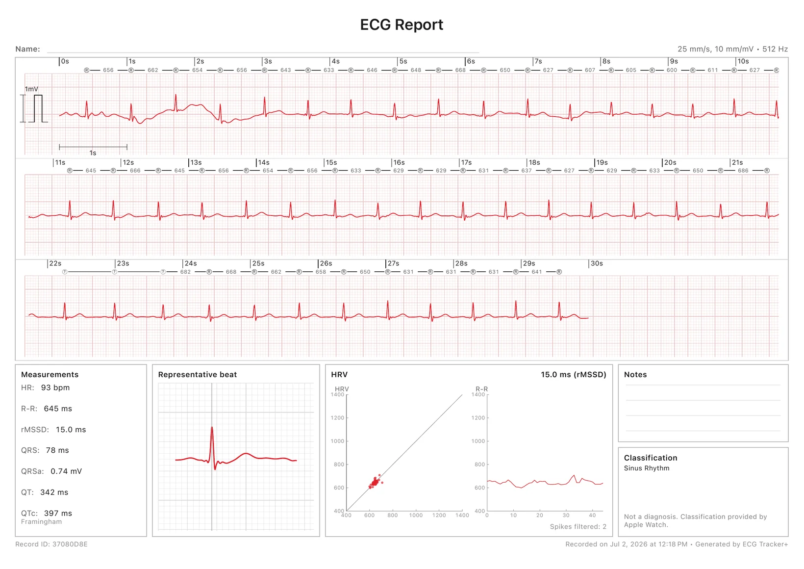 A print-ready ECG Tracker+ PDF report: a 30-second calibrated ECG strip with R-R markers, plus measurements, a representative beat, an HRV plot and the rhythm classification