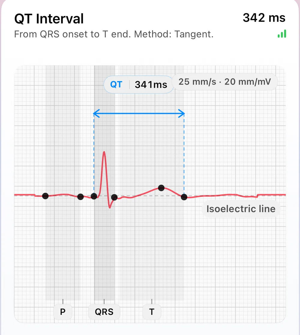 ECG Tracker+ Beat Morphology screen: a representative heartbeat built from the most stable beats, with P, QRS and T fiducial markers, the isoelectric line, and a 341 ms QT interval measured by the tangent method (QRS onset to T end)