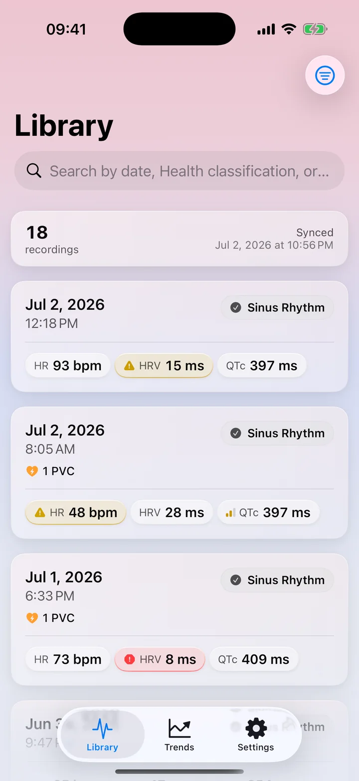 ECG Tracker+ library listing Apple Watch ECG recordings with rhythm classifications and key measurements