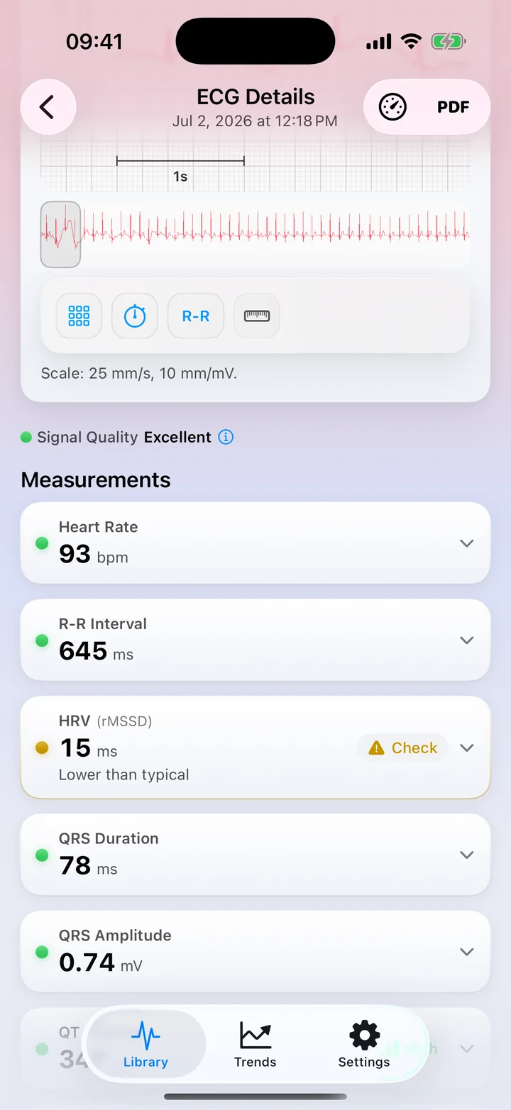 ECG Tracker+ Measurements screen with Signal Quality Excellent, heart rate, R-R interval, HRV, QRS duration and amplitude, each with a status dot