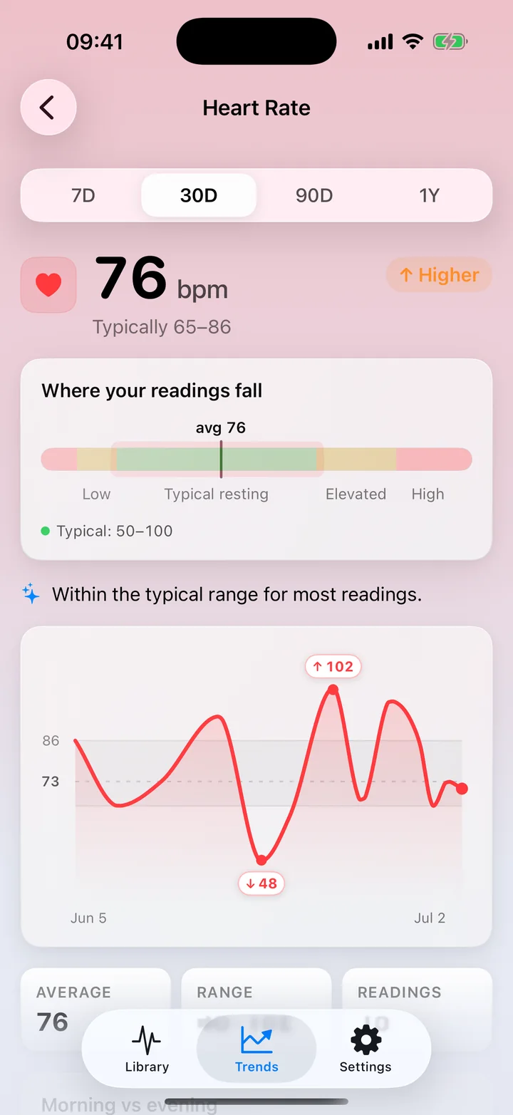 ECG Tracker+ Trends heart-rate detail: a 30-day average of 76 bpm within the typical range, a distribution bar and a line chart of daily readings with high and low points marked