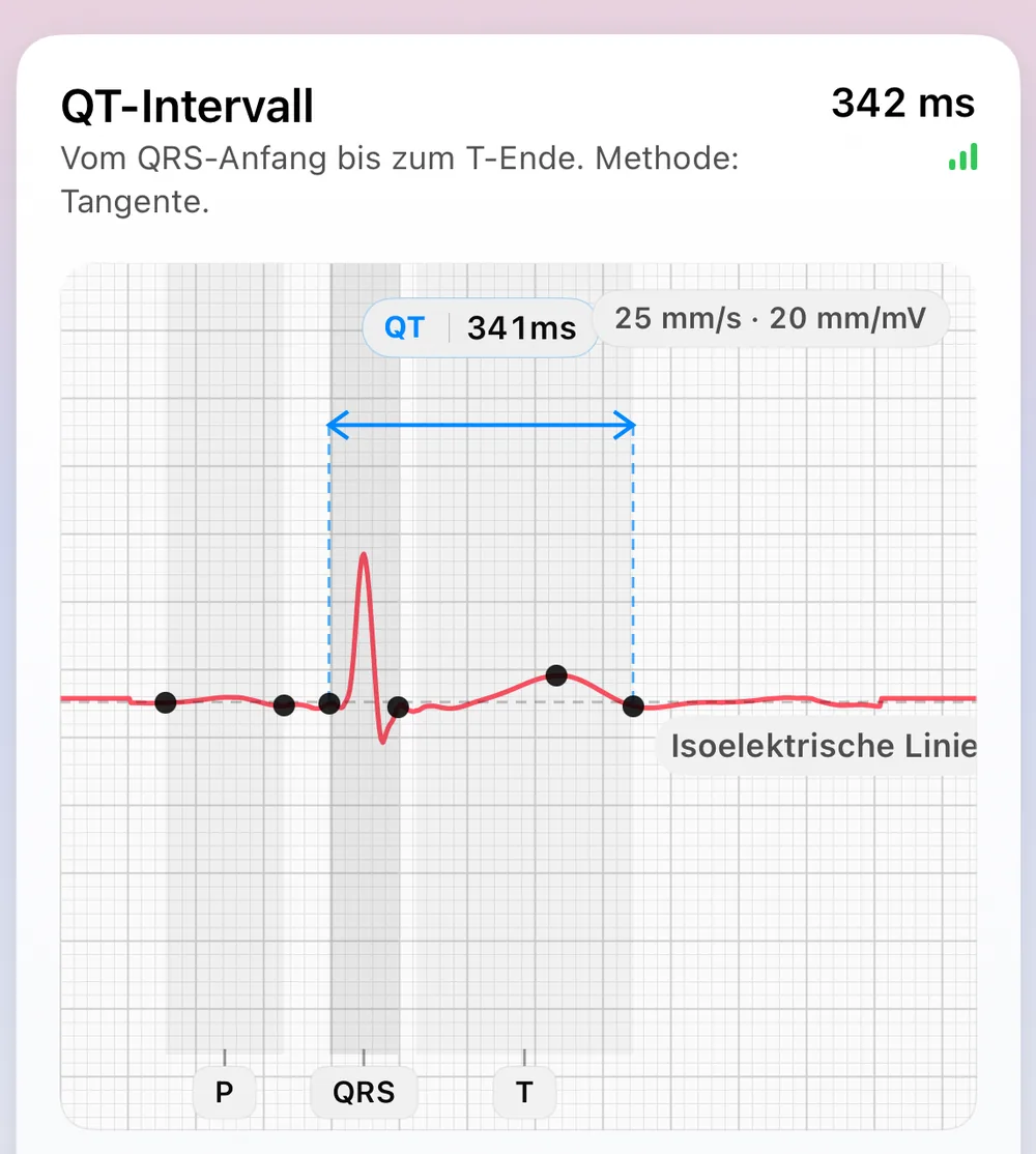 ECG Tracker+ Ansicht Schlagmorphologie: ein repräsentativer Herzschlag aus den stabilsten Schlägen, mit P-, QRS- und T-Markern, der isoelektrischen Linie und einem QT-Intervall von 341 ms, gemessen mit der Tangentenmethode (von QRS-Beginn bis T-Ende)