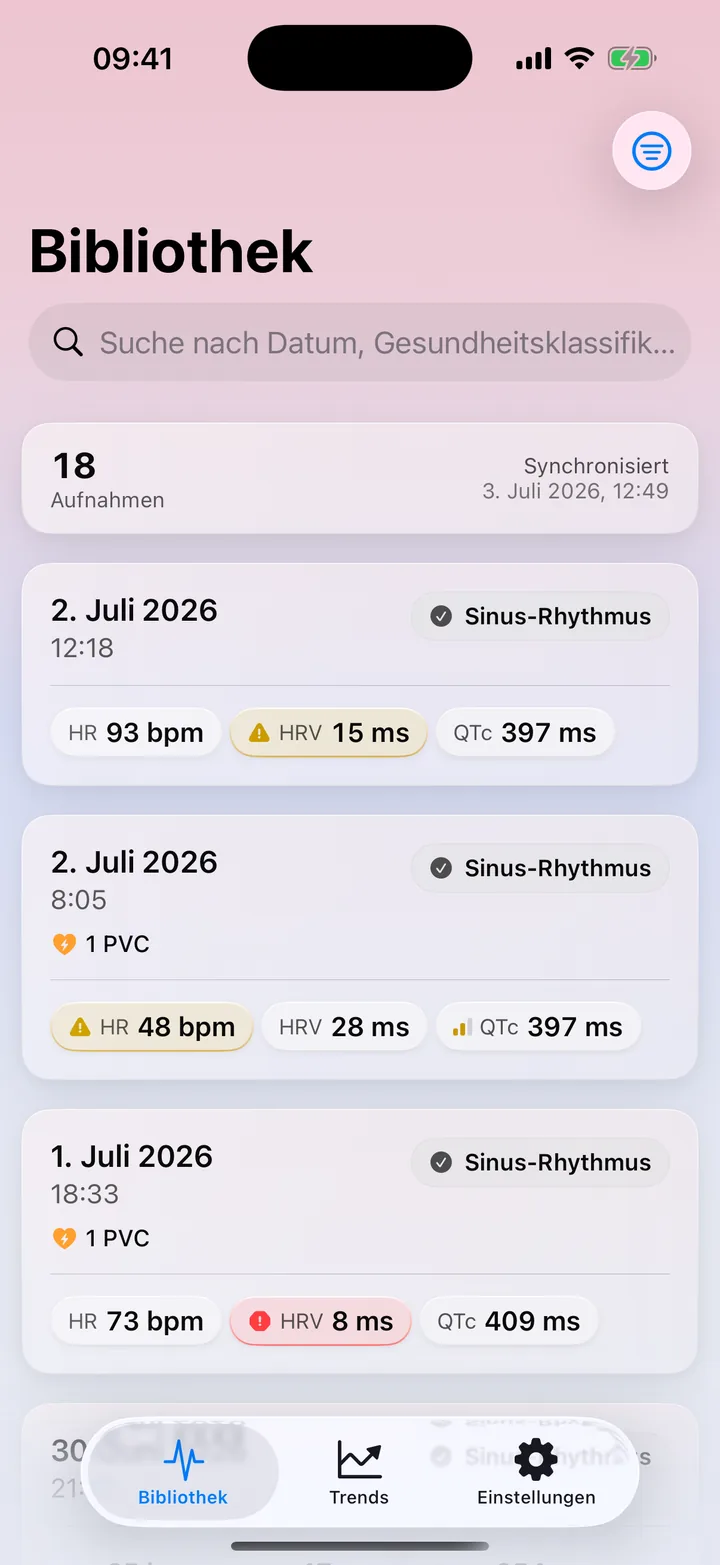 ECG Tracker+ Bibliothek mit Apple Watch EKG-Aufzeichnungen samt Rhythmus-Einordnung und wichtigsten Messwerten