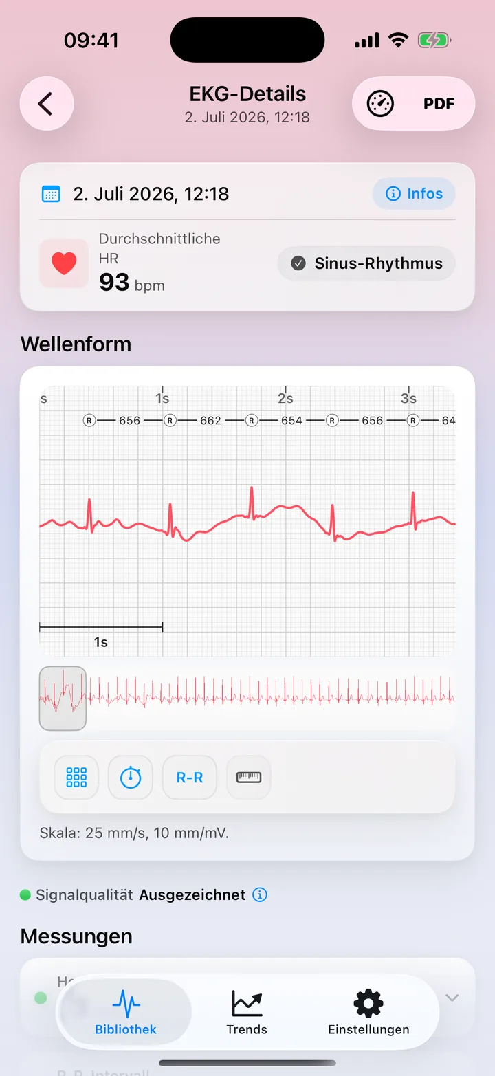 ECG Tracker+ Messwerte-Ansicht mit Signalqualität Ausgezeichnet, Herzfrequenz, R-R-Intervall, HRV, QRS-Dauer und -Amplitude, jeweils mit Statuspunkt
