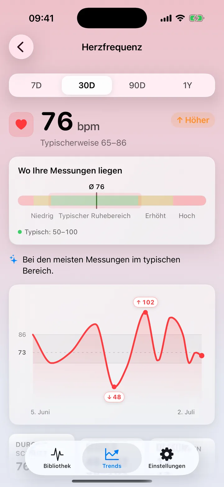 ECG Tracker+ Trends, Herzfrequenz-Detail: ein 30-Tage-Durchschnitt von 76 bpm im typischen Bereich, ein Verteilungsbalken und ein Liniendiagramm der täglichen Werte mit markierten Hoch- und Tiefpunkten