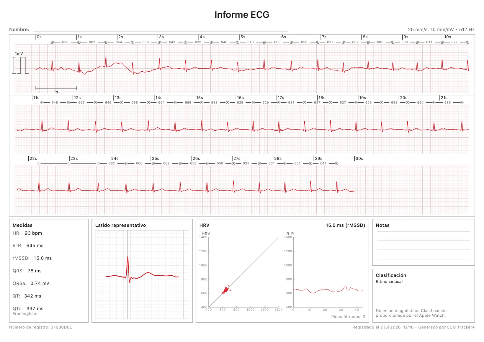 Un informe PDF de ECG Tracker+ listo para imprimir: una tira de ECG calibrada de 30 segundos con marcadores R-R, además de las mediciones, un latido representativo, un gráfico de HRV y la clasificación del ritmo