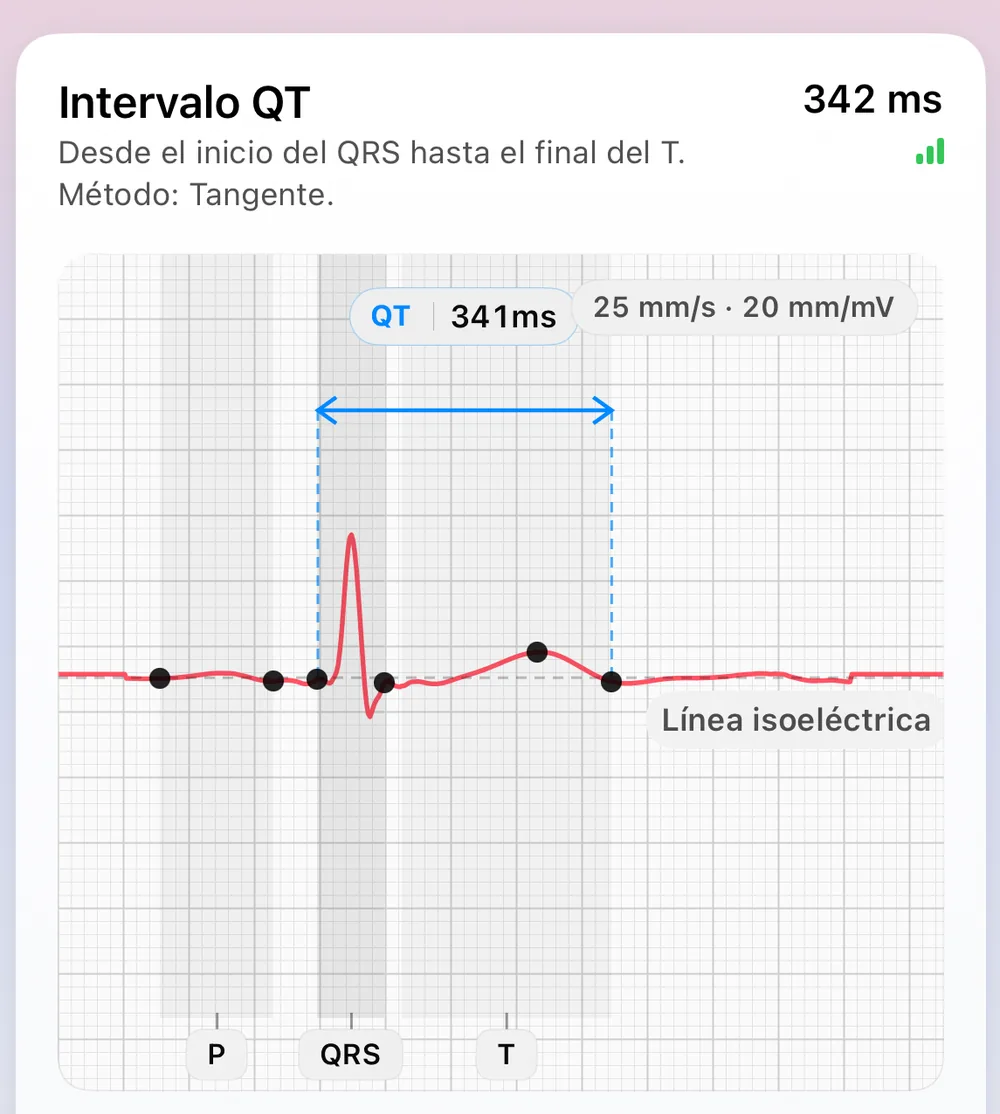 Pantalla de Morfología del latido de ECG Tracker+: un latido representativo construido a partir de los latidos más estables, con los marcadores fiduciales P, QRS y T, la línea isoeléctrica y un intervalo QT de 341 ms medido con el método de la tangente (del inicio del QRS al final de la T)