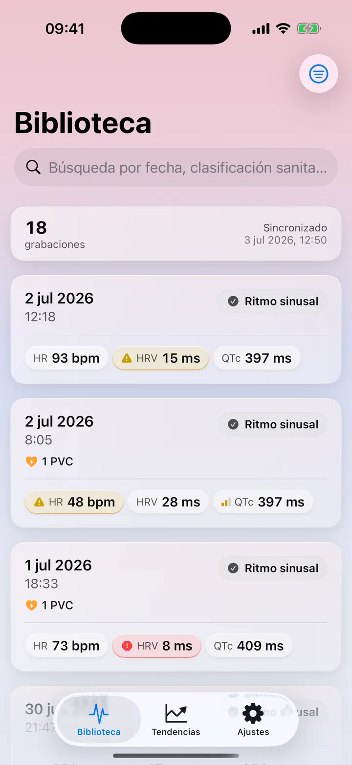 Biblioteca de ECG Tracker+ con las grabaciones de ECG de Apple Watch, su clasificación del ritmo y las mediciones principales