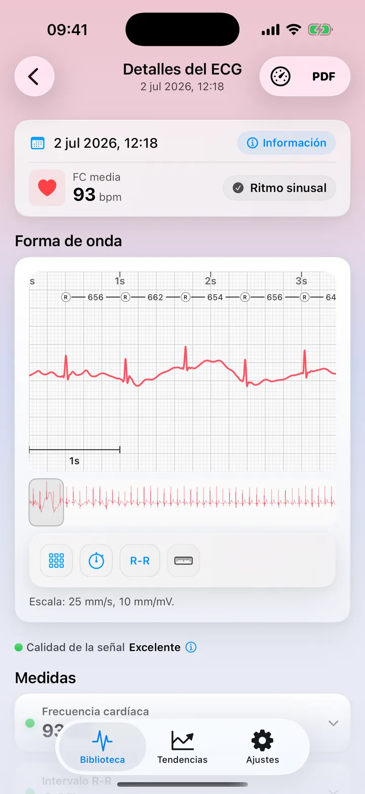 Pantalla de Mediciones de ECG Tracker+ con Calidad de la señal Excelente, frecuencia cardíaca, intervalo R-R, HRV, duración y amplitud del QRS, cada uno con un punto de estado