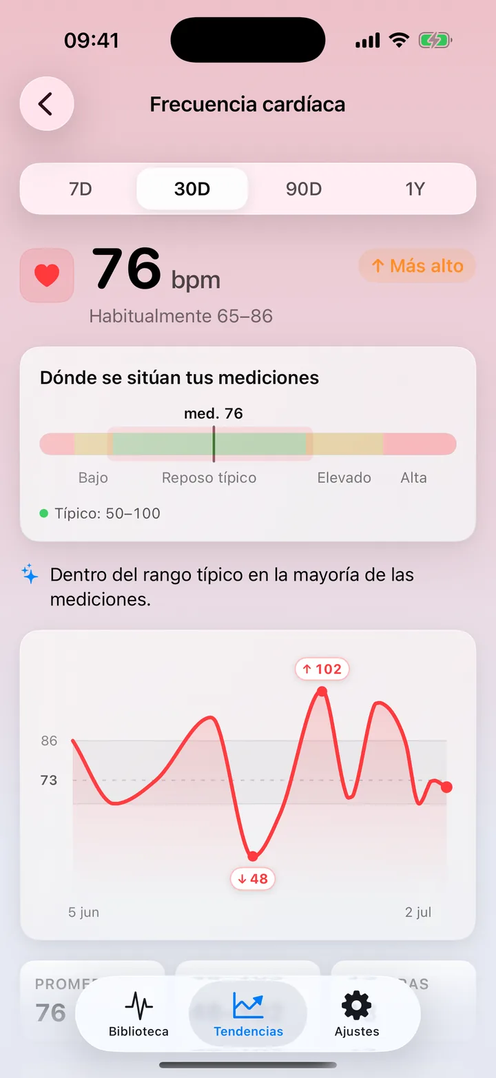Detalle de frecuencia cardíaca en Tendencias de ECG Tracker+: una media de 76 bpm en 30 días dentro del rango habitual, una barra de distribución y un gráfico de líneas de las lecturas diarias con los puntos máximo y mínimo marcados