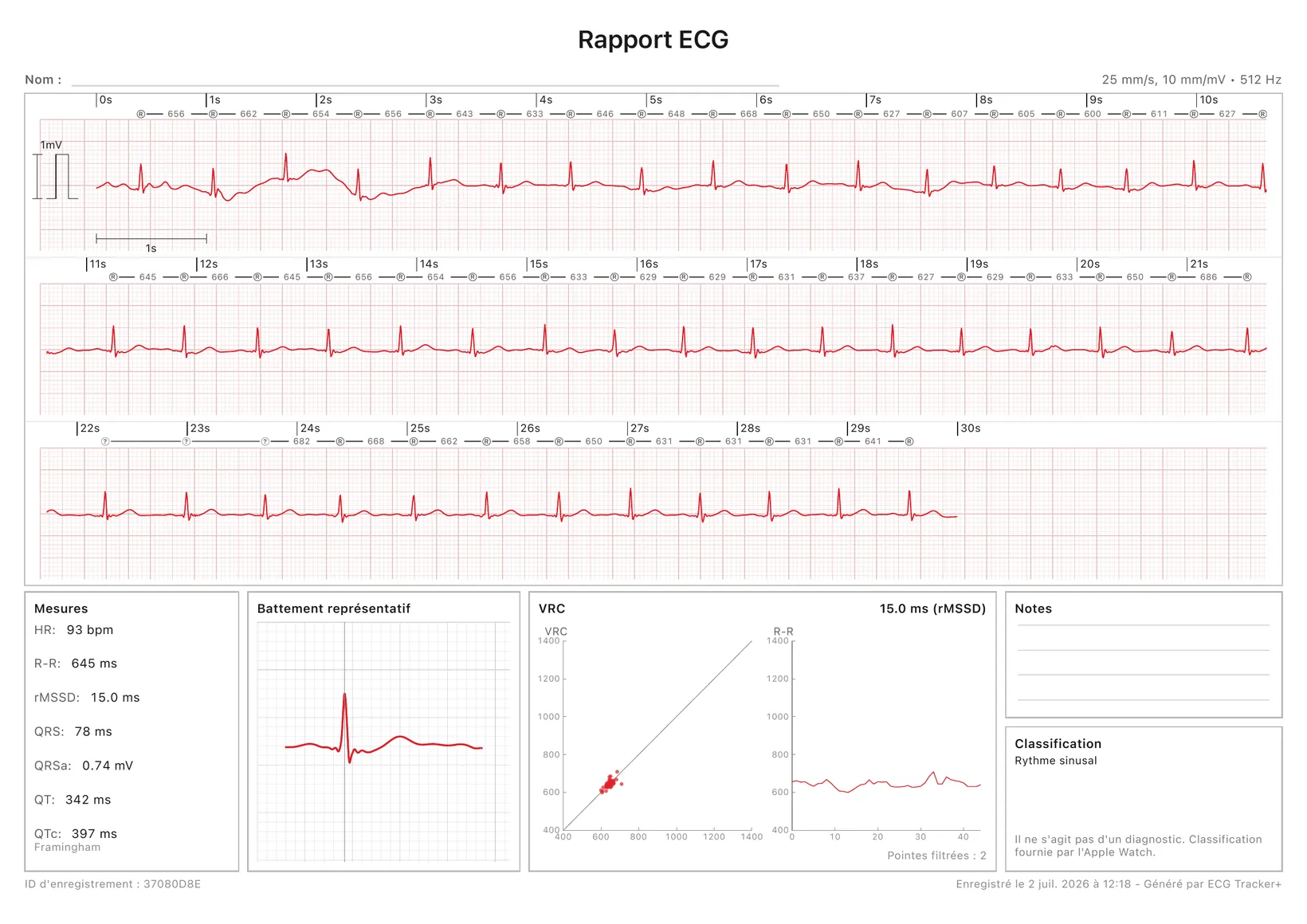Un rapport PDF d'ECG Tracker+ prêt à imprimer : un tracé ECG calibré de 30 secondes avec repères R-R, plus les mesures, un battement représentatif, un graphique de HRV et la classification du rythme